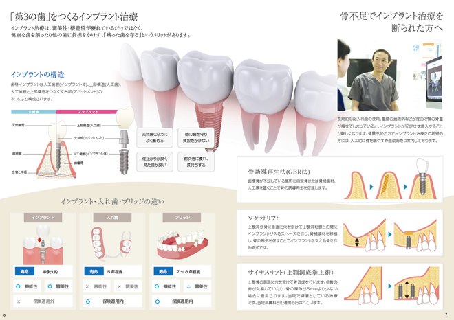 インプラント治療の基本を解説した資料の誌面