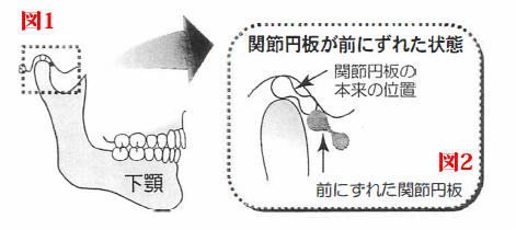 顎関節クリニック 練馬区江古田のおざわ歯科インプラントクリニック